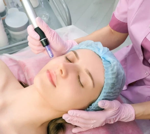 Microneedling - Exmouth